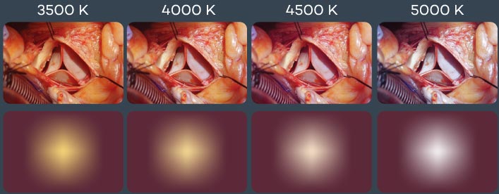 Surgical Operating Light