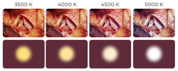 Surgical light with Adjustable Colour Temperature